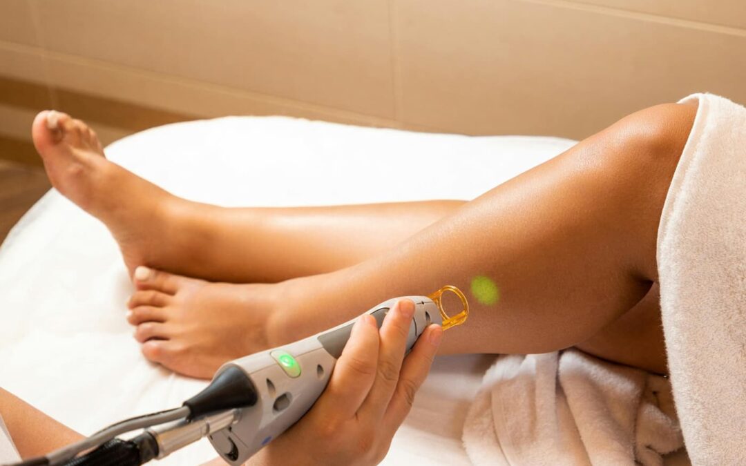 Depilación láser en Santa Coloma de Gramenet: la tecnología que transforma tu piel