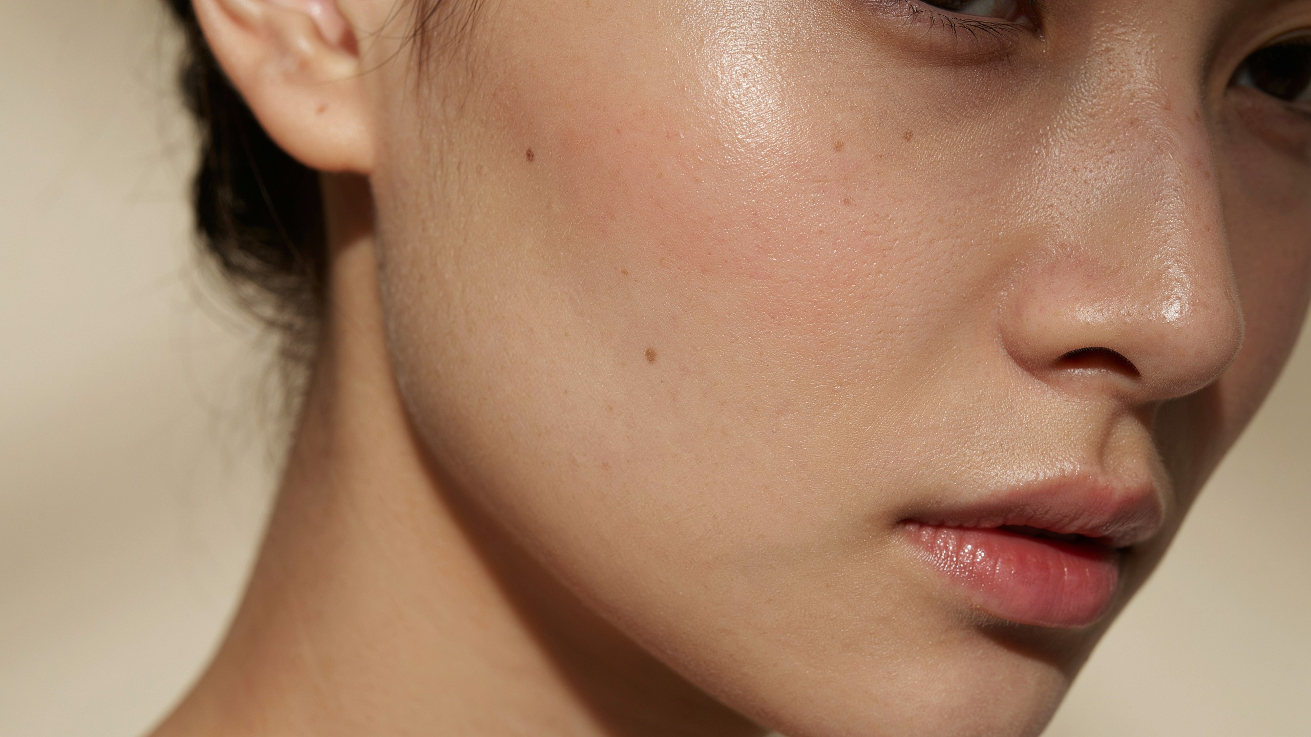 Resultados de peeling facial en otoño - Salon4